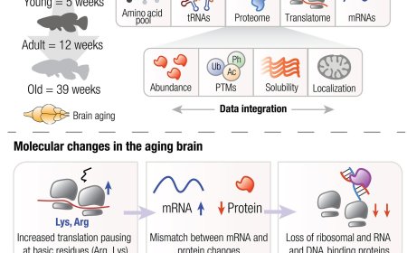 Altered protein translation elongation contributes to brain aging