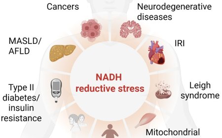 NADH reductive stress drives metabolic reprogramming
