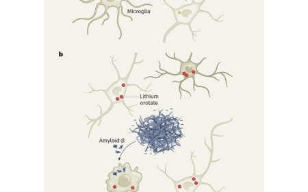Lithium deficiency may lead to Alzheimer’s disease