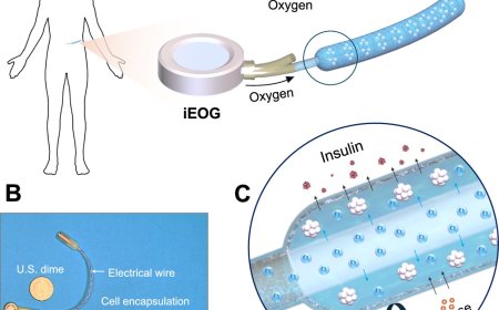 Implant treats Type 1 diabetes by oxygenating insulin-producing cells