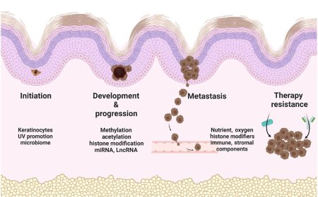 Epigenetic mechanisms in melanoma development and progression