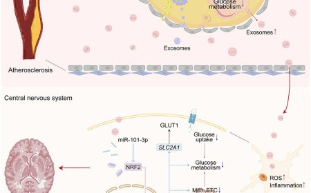 How foam cell-derived exosomes exacerbate ischemic white matter injury?