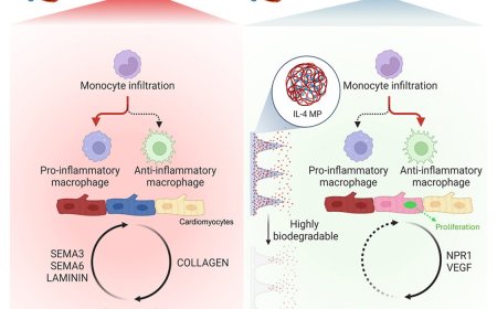 Immunomodulatory microneedle patch for cardiac repair!