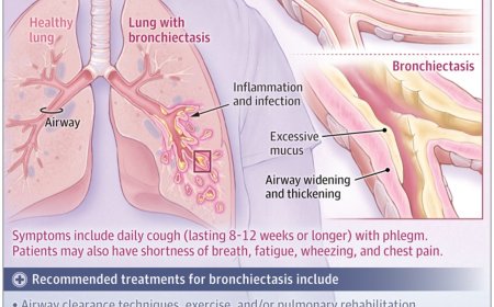 What Is Bronchiectasis?
