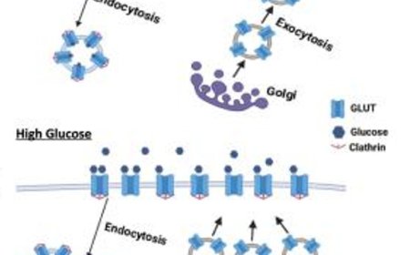 Glucose transporter dysregulation in type 2-diabetes