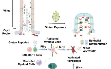 How cells in small intestine of people with coeliac disease communicate with one another