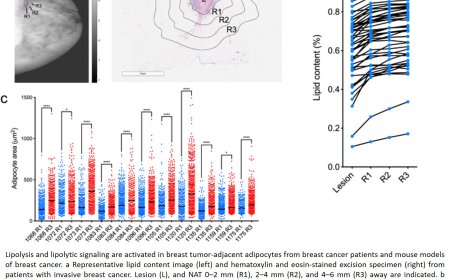 Breast tumors tunnel into fat cells to fuel up