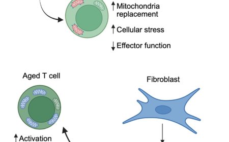 Mitochondria and lysosomes in T cell immunometabolism