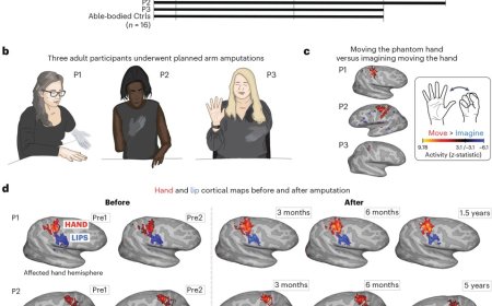 Brain’s map of the body remains unchanged after amputation
