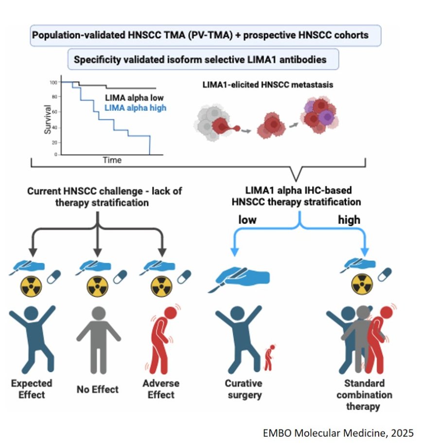 LIMA1-alpha staining predicts curative intent surgery response in HPV negative head and neck cancer