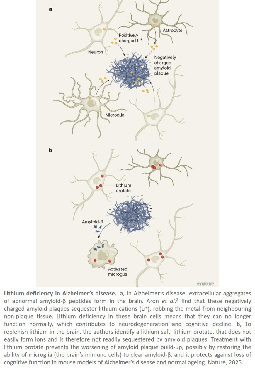 Lithium deficiency and the onset of Alzheimer’s disease