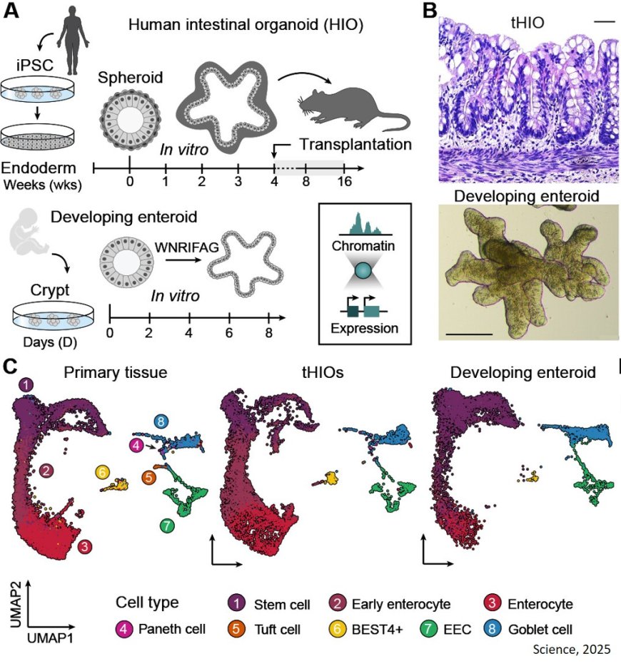 Evolutionary changes in the developing human intestine