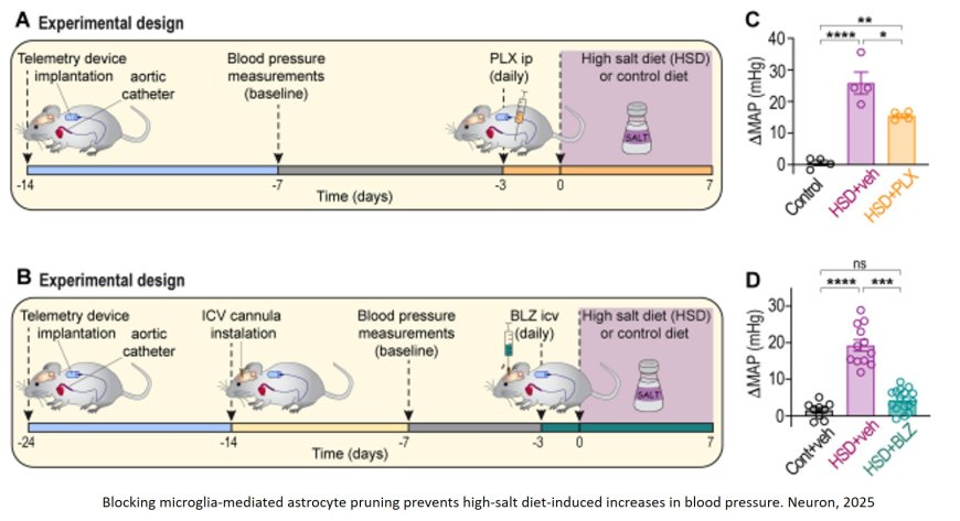 High-salt diet inflames the brain and raises blood pressure