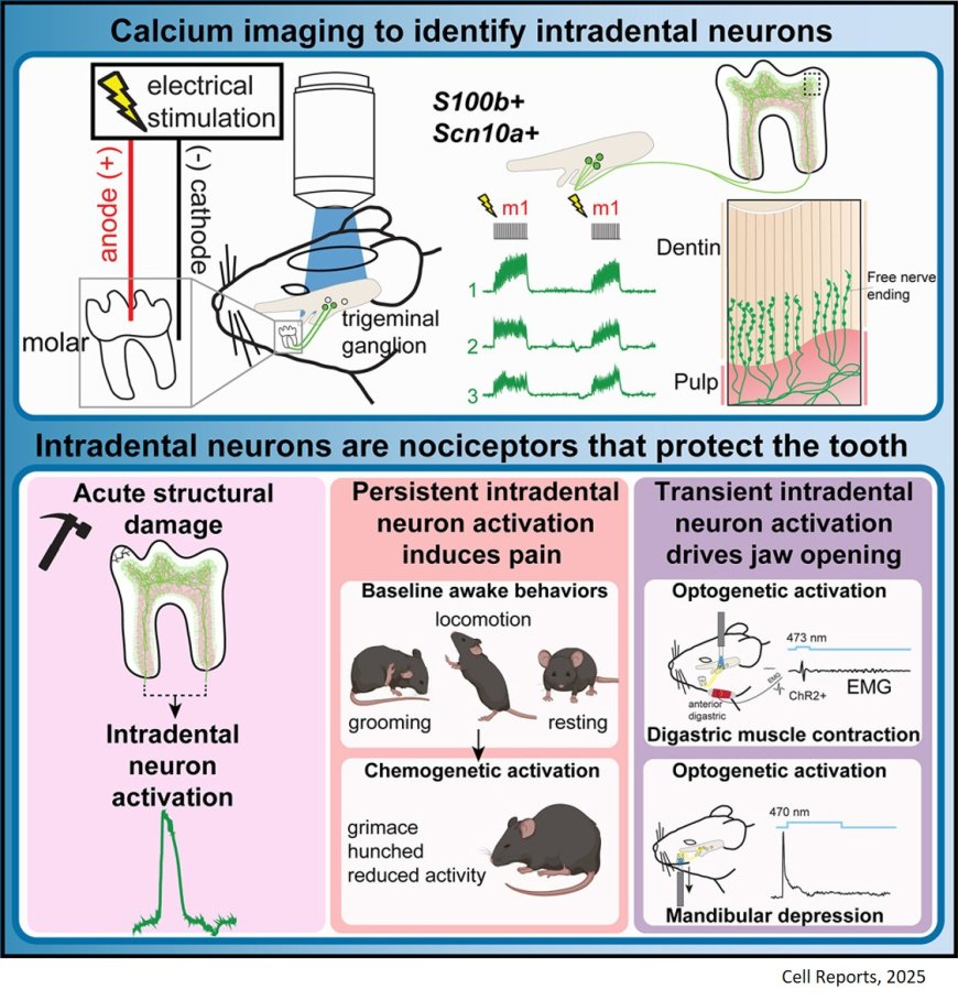 Intradental mechano-nociceptors serve as sentinels that prevent tooth damage