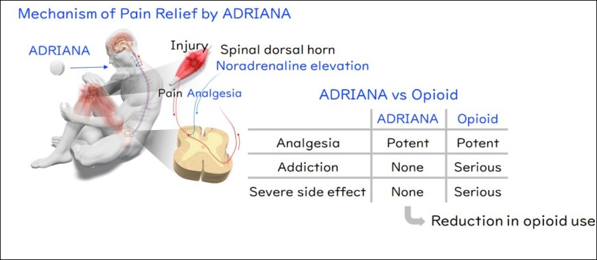 A new analgesic promises pain relief with fewer downsides