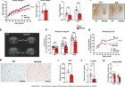 Neuritin 1 acts as a local metabolic regulator of brown adipose tissue