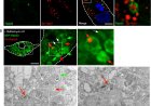 Macrophages swallow damaged mitochondria through microautophagy