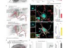 New implant restores blood pressure balance after spinal cord injury