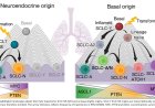 Basal stem-like cells identified as origin of small cell lung cancer
