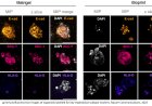 Trophoblast differentiation in 3D bioprinted miniature placentas