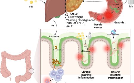Interplay between diet–pathobiont in health and inflammatory bowel disease