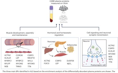 Proteomics and AI detects early signs of ALS in plasma years before symptoms appear