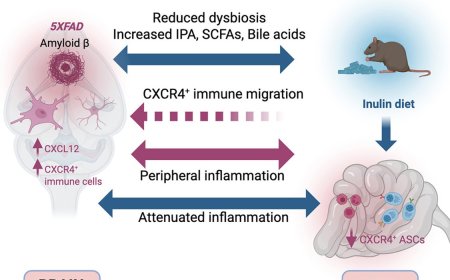 The gut immune system is altered in mouse model of Alzheimer’s