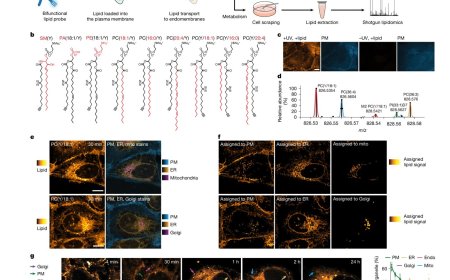 Fat microscopy to image lipids in cells