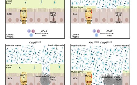 Suppressing necroptosis-induced colitis