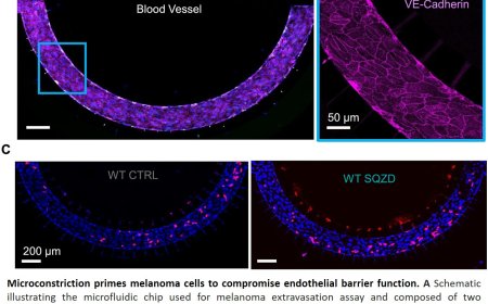 How capillary constriction triggers metastasis