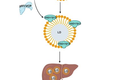 Link between excessive alcohol and fatty liver disease