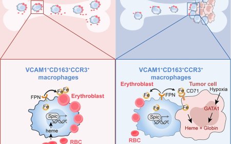Tumors hijack macrophages for iron supply to promote bone metastasis and anemia