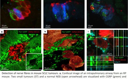 How small cell lung cancer hijacks neuronal synapses