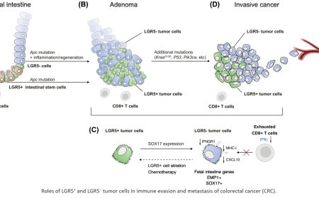 Interplay between stem cells and the tumor microenvironment in early immune evasion in colorectal cancer