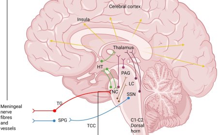 Migraine treatment advances!