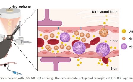 Alleviating depression by delivering mono-clonal antibodies to brain