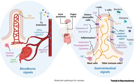 Sensory signals for nausea