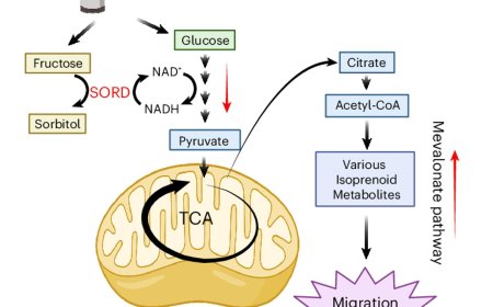 How sugary drinks enhance colorectal cancer metastasis