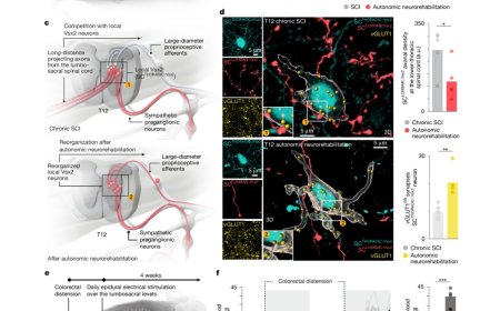 New implant restores blood pressure balance after spinal cord injury