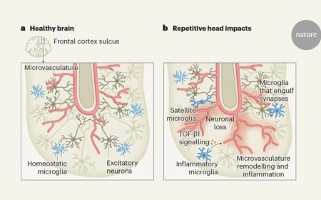 Neurodegeneration from repeated head trauma in young athletes