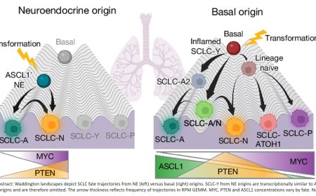 Basal stem-like cells identified as origin of small cell lung cancer