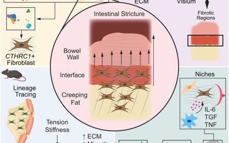 ‘Creeping fat’ can worsen Crohn’s disease