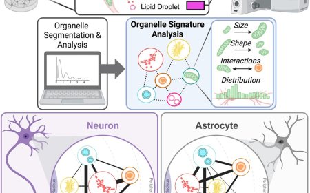 Distinct organelle signatures and stress response in neurons and astrocytes