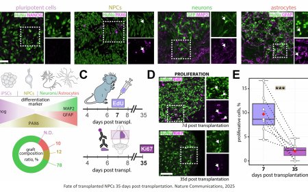 Stem cell transplant for stroke leads to brain cell growth and functional recovery in mice