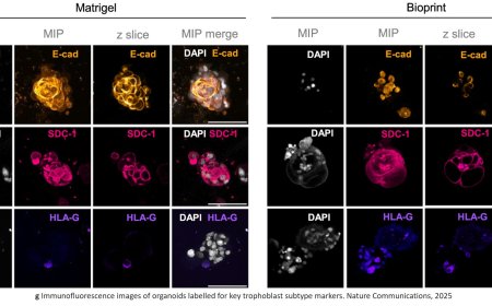 Trophoblast differentiation in 3D bioprinted miniature placentas