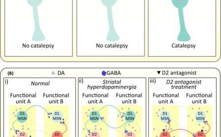 The striatal dopamine system in schizophrenia