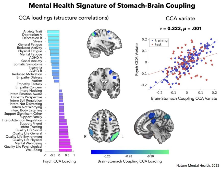 Stomach–brain synchronisation is associated with poorer mental health