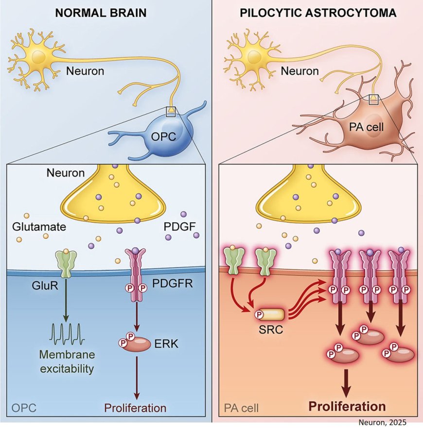 Aberrant coupling of glutamate and tyrosine kinase receptors enables neuronal control of brain-tumor growth