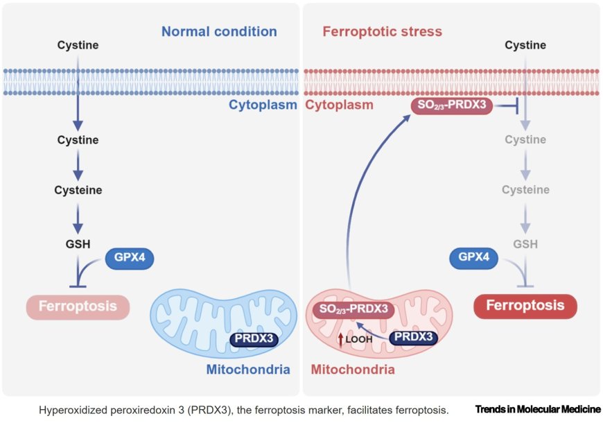 MAFLD is a ferroptotic disease