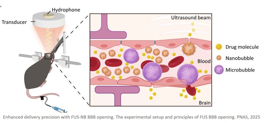 Precise antibody delivery to the brain via nanobubble-actuated focused ultrasound alleviates depression